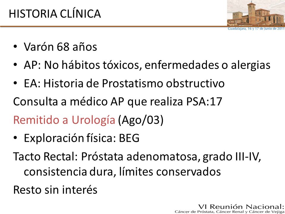 próstata asimétrica que significa el próstata asimétrica que significa el